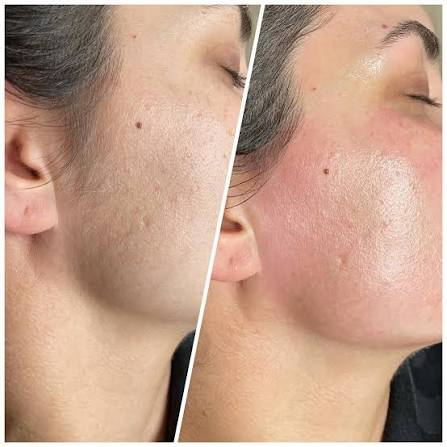 Full Face Waxing