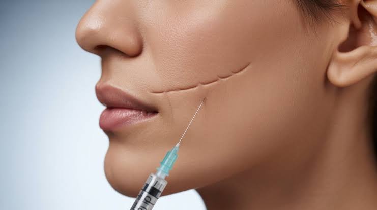 Close-up of a woman’s cheek considering who should get side of face waxing