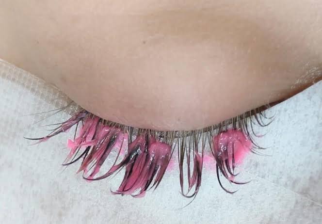 Eyelash Removal